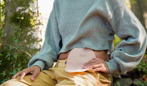 Ostomy Bags for Sensitive Skin: Choosing Comfort and Protection