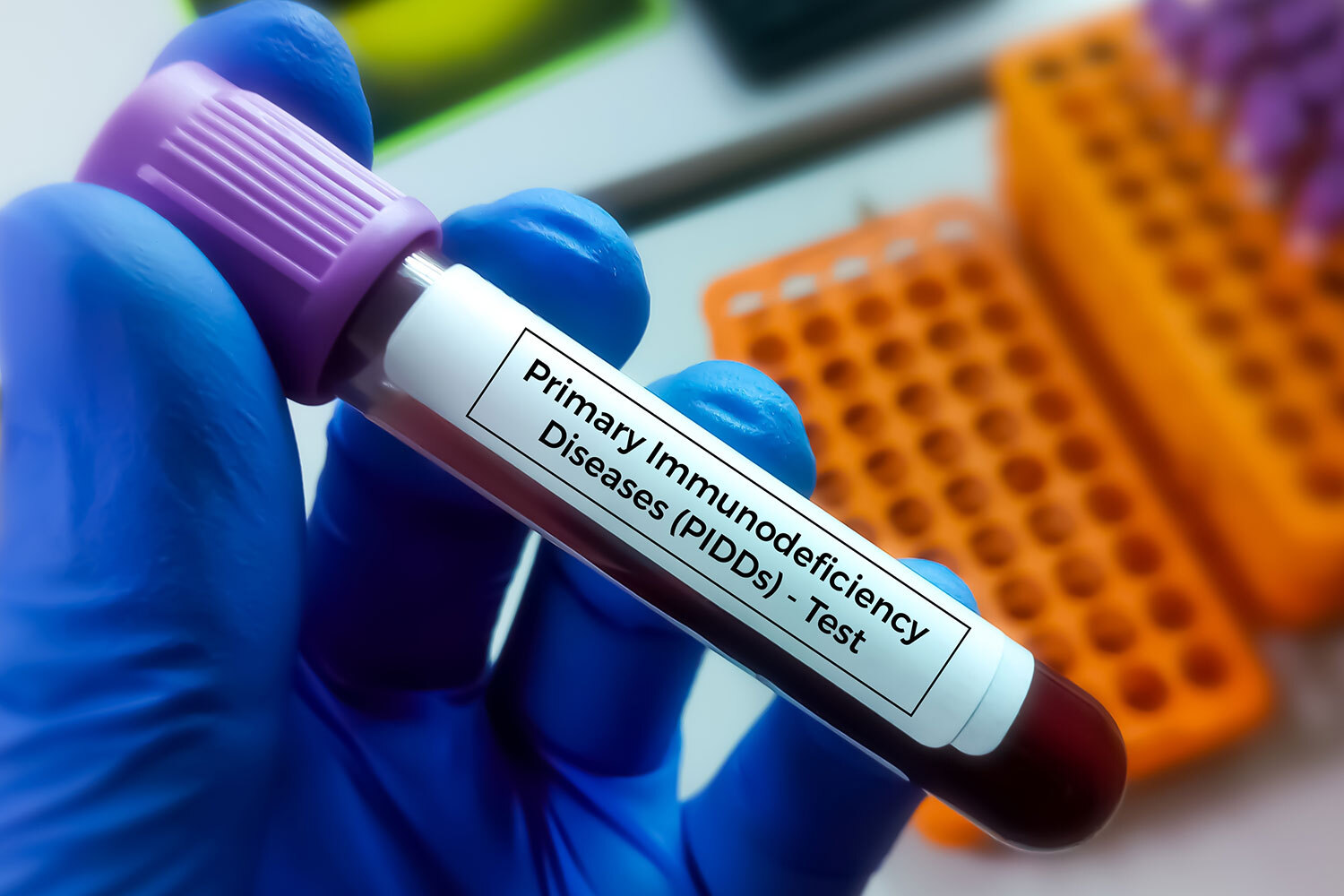 Understanding Primary Immunodeficiency Disease: Causes, Symptoms, and Treatment